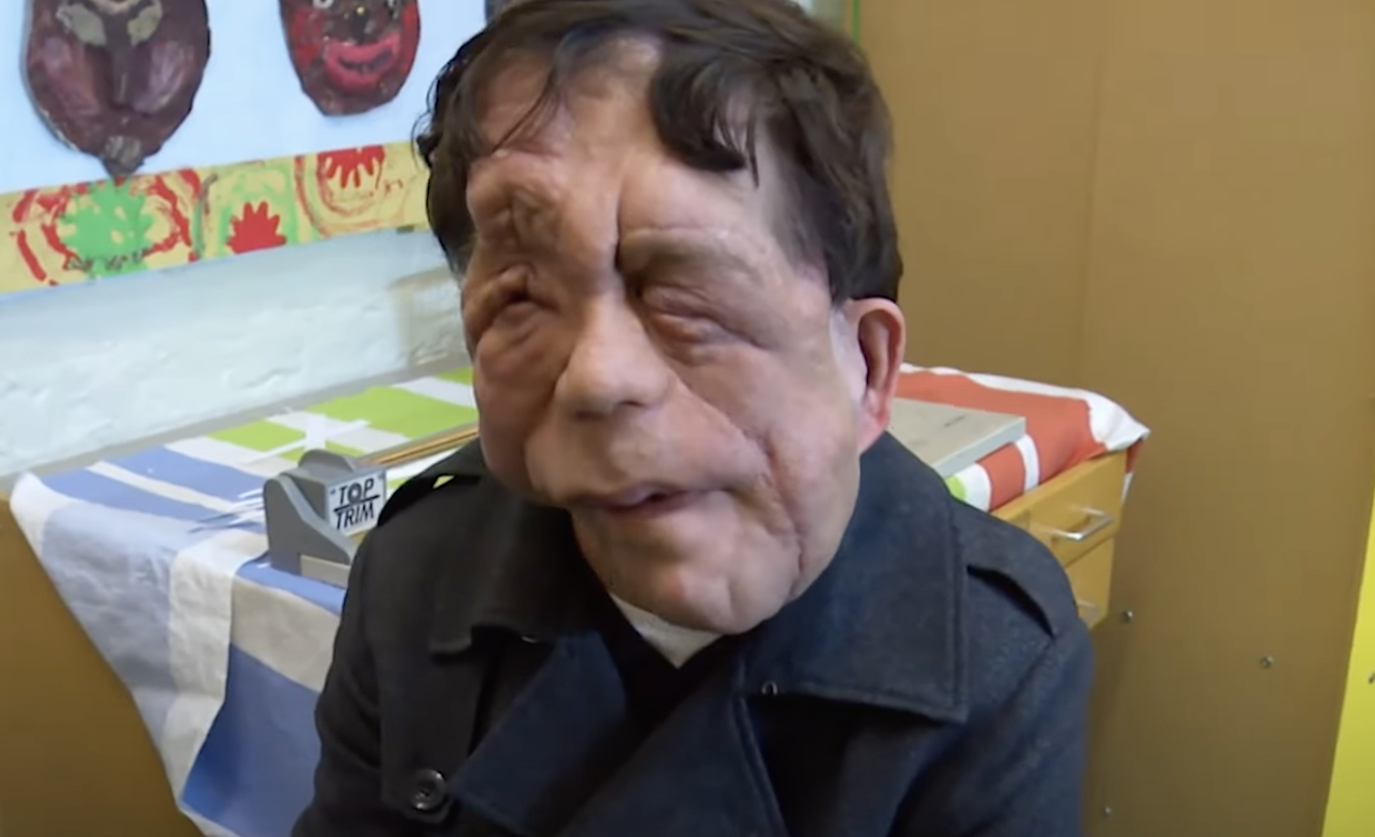 Living with disabilities